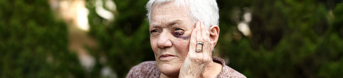 Older woman with a black eye looking sad.
